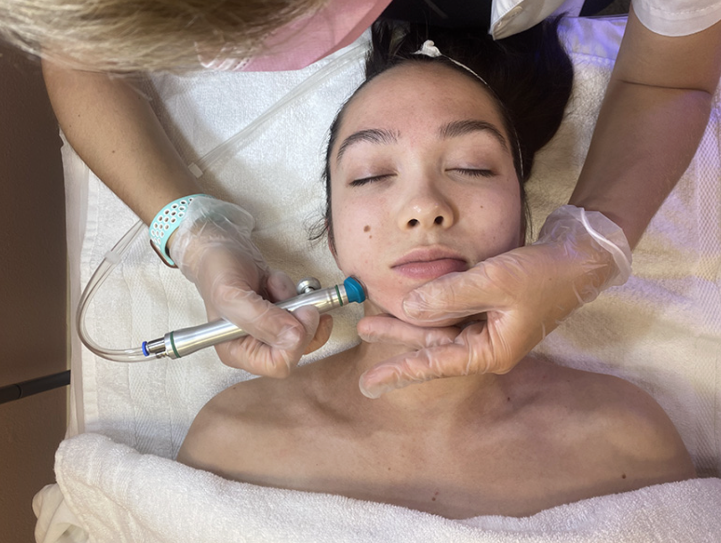 HydraFacial treatment